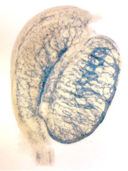 KDR positive staining in E13 ovary
