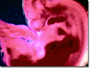 Picture of a Pig Embryo